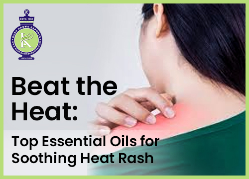 Beat the Heat: Top Essential Oils for Soothing Heat Rash
